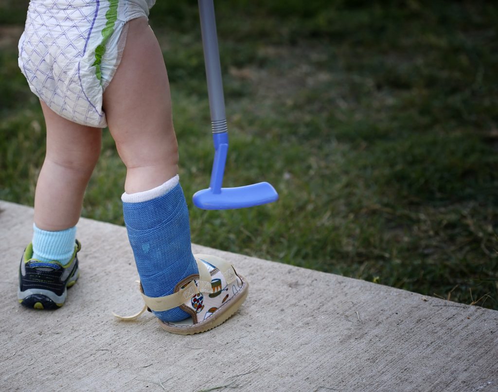 Child Broken Bone